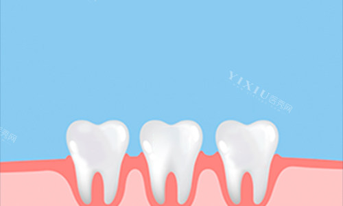 牙齿动画展示图