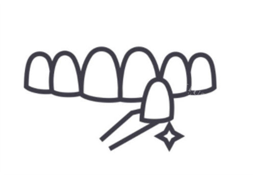 牙齿贴面卡通图