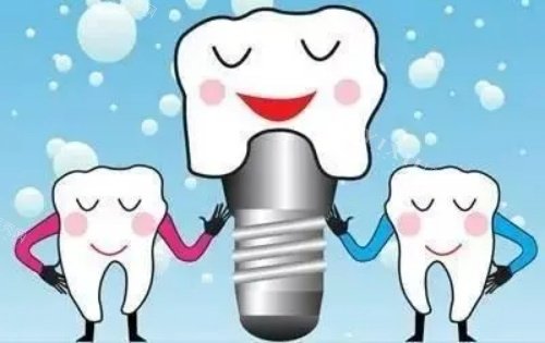 牙齿种植体示意图
