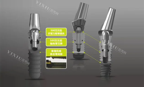 百康特种植牙怎么样