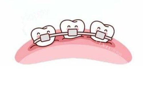 畸形牙齿矫正卡通图