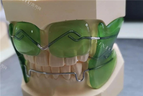 法兰克3矫正器图片