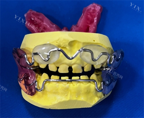 法兰克3功能矫正器