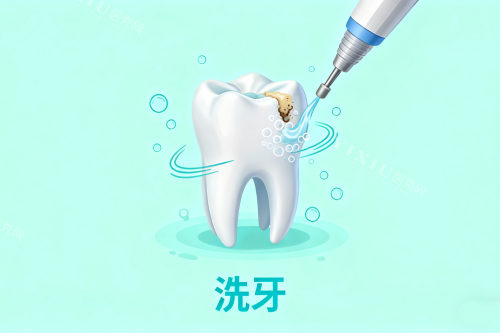 洗牙卡通展示图