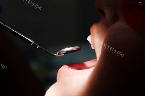 牙齿检查展示图