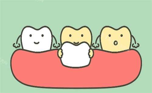 瓷贴面美白牙齿动画展示图