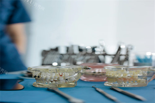 牙齿治疗的模型图