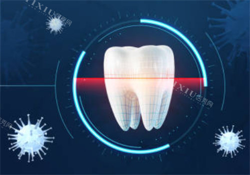 牙齿检查是否有细菌图