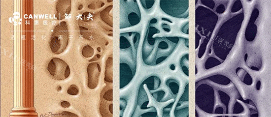 科惠种植牙骨密度检测