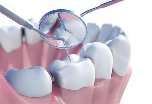 牙齿检查卡通图展示