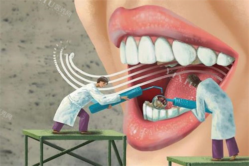 牙齿检查做治疗图