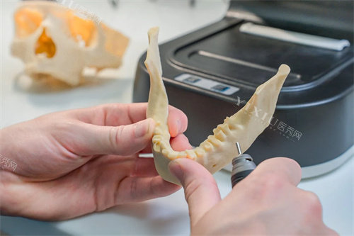 牙齿模型材料示意图