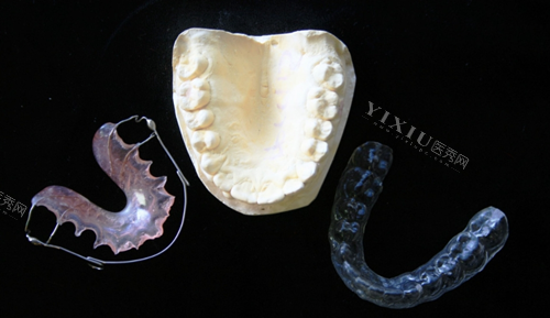 牙齿矫正模型图