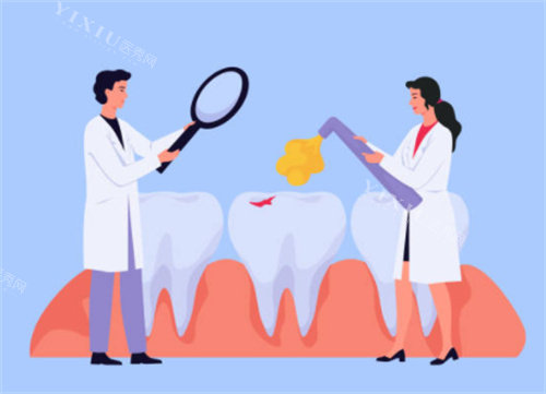 牙齿检查示意图