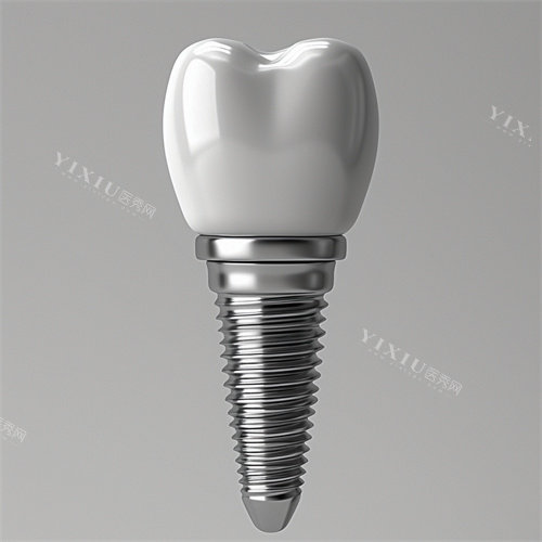 种植牙植体和牙冠一提漫画示意图