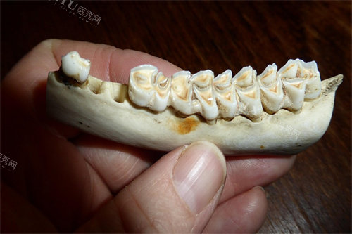 假牙模型展示