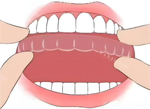 隐形矫正图片展示