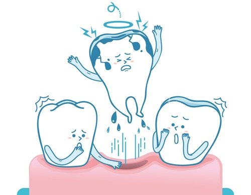 牙齿脱落漫画示意图