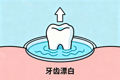 牙齿漂白卡通图