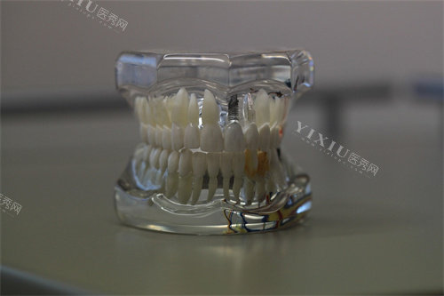 牙齿模型示意图宣传