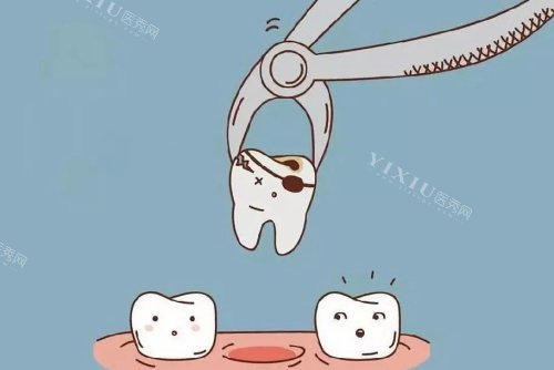 牙齿种植拔牙卡通示意图