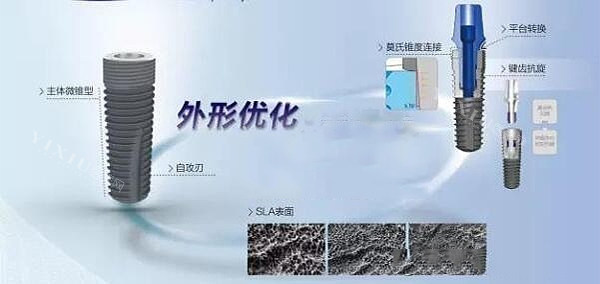 威高wego种植牙品牌好不好