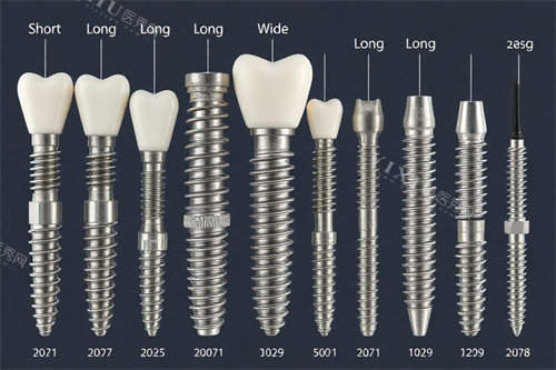 种植牙不同类型图