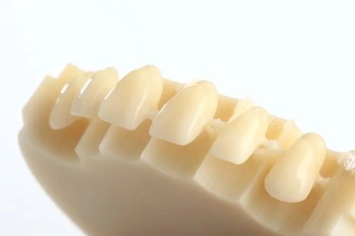 国产美晶瓷全瓷牙展示图