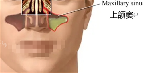 上颌窦位置展示
