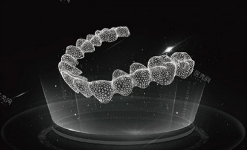 隐形牙套图示 (2)