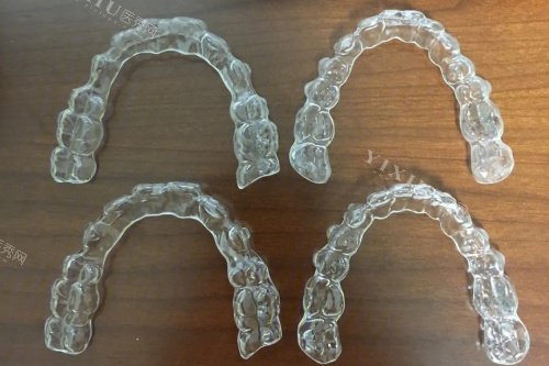 隐形牙套示意图