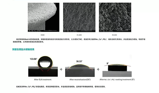 韩国inno伊诺种植牙好不好