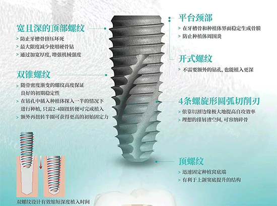 韩国伊诺种植牙植体照片