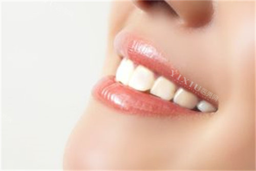 洁白整齐的牙齿宣传图