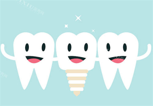 种植牙和健康牙齿图