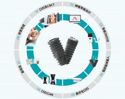 沃兰种植牙全部流程图