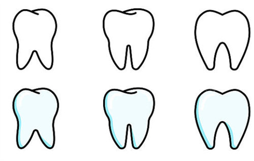 牙齿不同状态