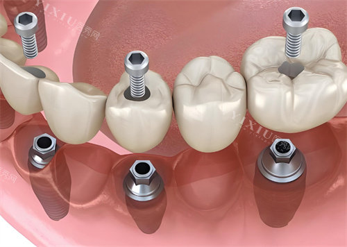 长春益牙优口腔怎么样？正规资质、可靠技术、贴心服务，多方位解析给你答案！(图3)