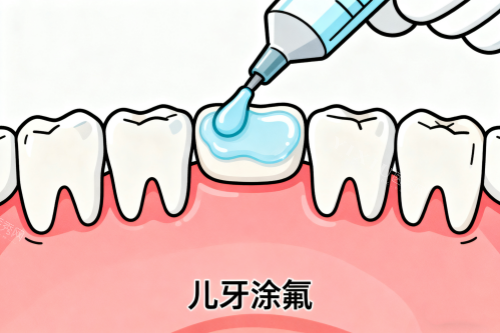 儿牙涂氟卡通图片展示