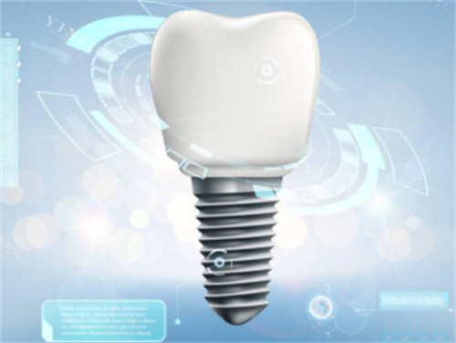 种植牙背景图