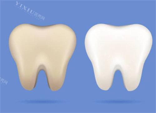 牙齿美白前后图