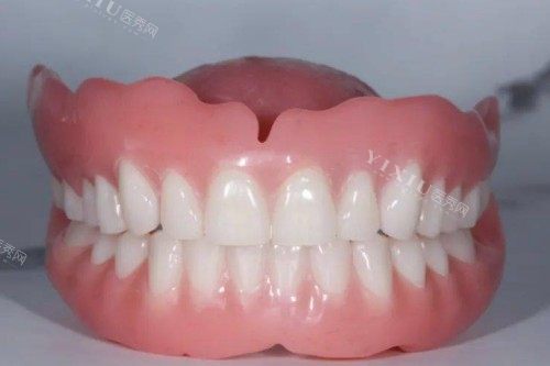 老年人假牙图片展示