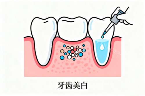 牙齿美白卡通展示图
