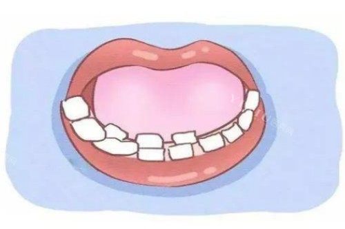 乳牙滞留卡通图片