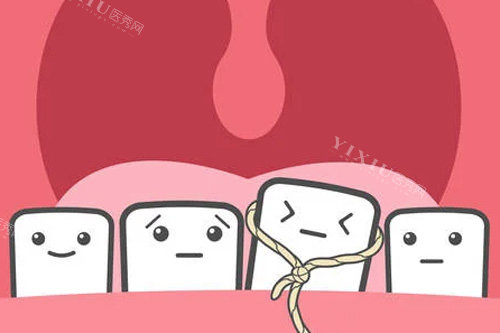 乳牙滞留拔除示意图