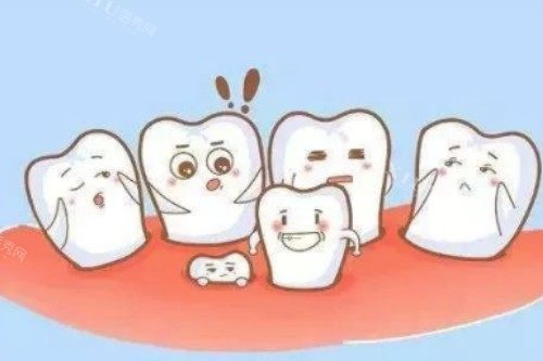乳牙问题卡通图