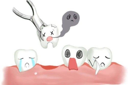 拔牙卡通展示图