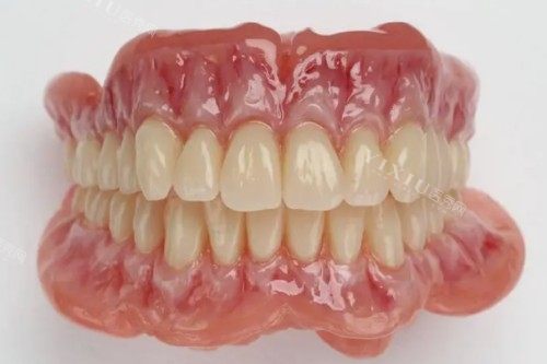 吸附性义齿模型图片展示
