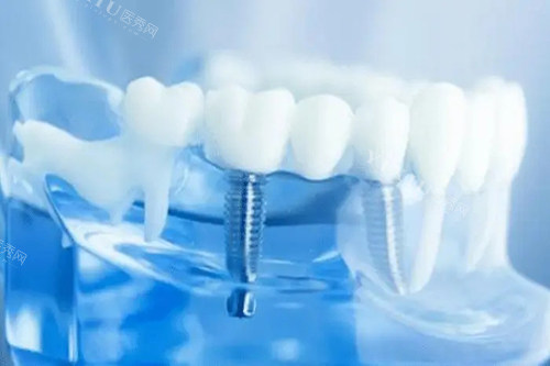 兰州皓亚口腔内部环境