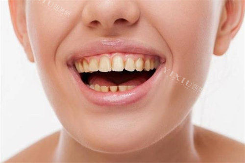 发黄的牙齿